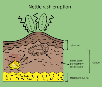 Chondroitin itching